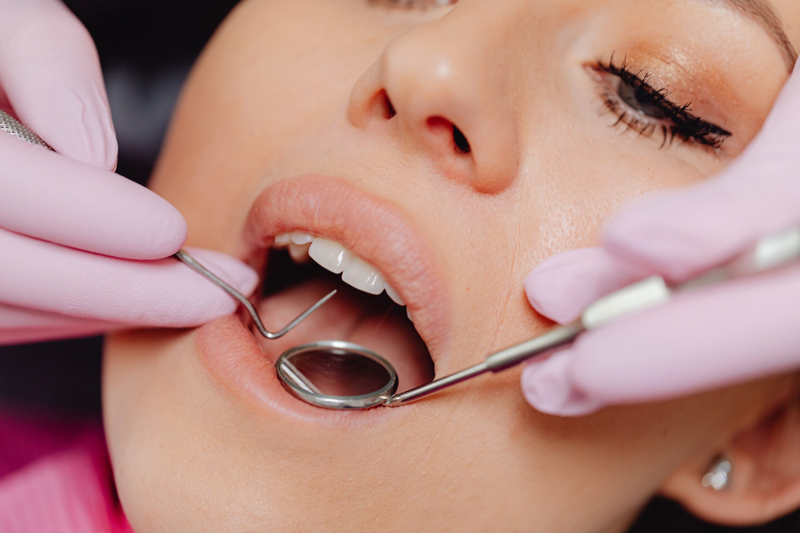restauracao-dental-1-scaled